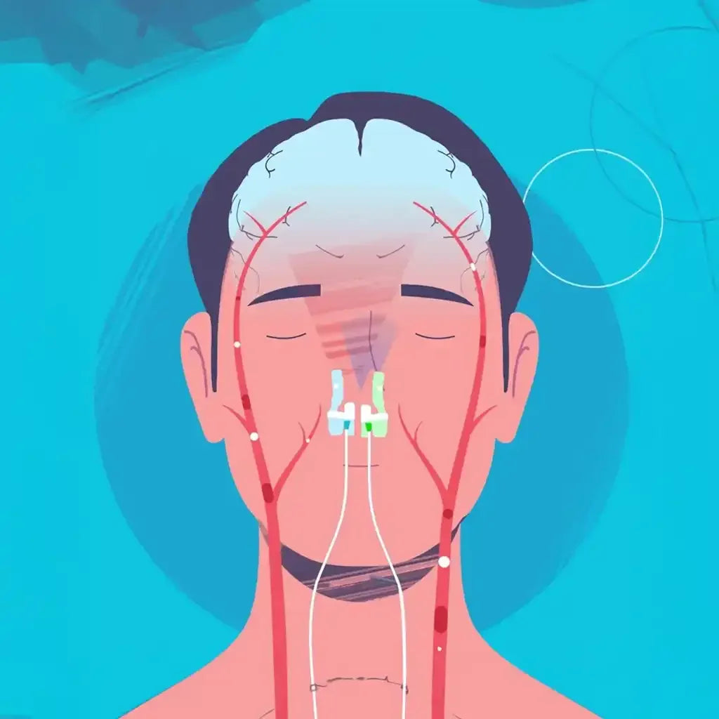 Dispositif intranasal Vielight - Bioledherapy