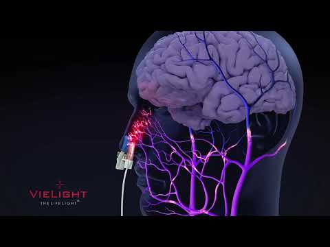 Vielight 633/655nm Systemic Intranasal-only Visualization

